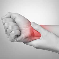 carpal tunnel syndrome